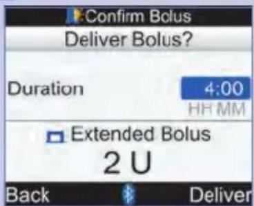 Confirm Bolus Deliver Bolus? Duration 4:00 HH MM Extended Bolus 2 U Back Deliver
