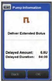 Accu-Chek Insight Diabetes Therapy System - Programming and Delivering an Extended Bolus - 4