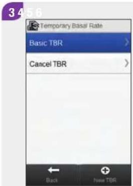 Accu-Chek Insight Diabetes Therapy System - Programming a Basic Temporary Basal Rate (TBR) - 3