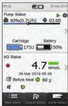 Accu-Chek Insight Diabetes Therapy System - Programming a Basic Temporary Basal Rate (TBR) - 6