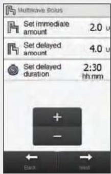 Accu-Chek Insight Diabetes Therapy System - 2 - 2