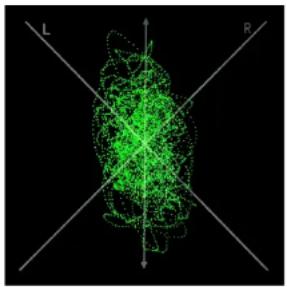 Green 3D molecular structure with directional axes labeled L and R (no text or symbols on the structure itself)