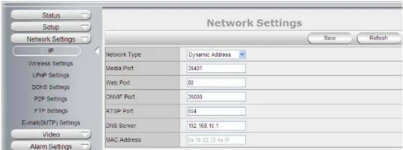 Pyle PIPCAMHD82 - Audio Settings - 2