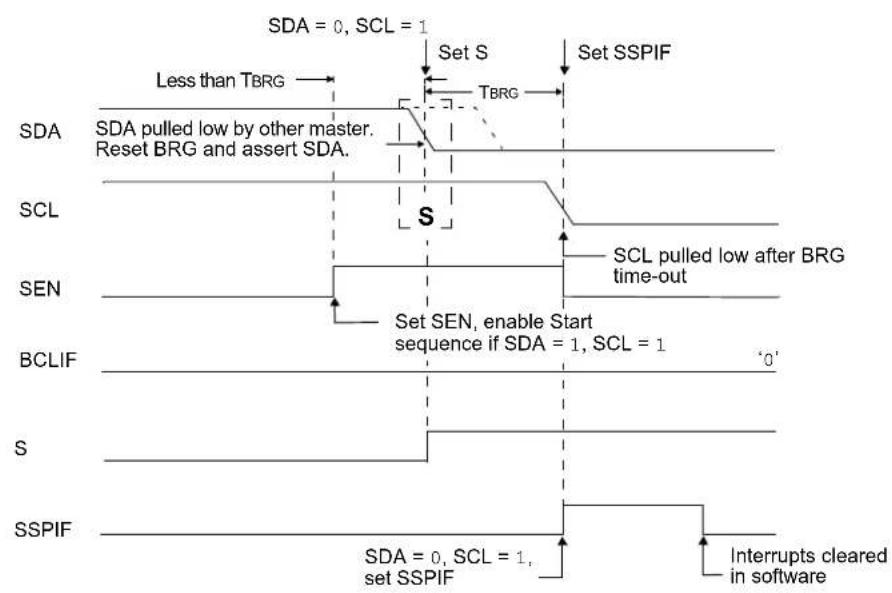 Microchip PIC18F86J93 - Bus Collision During a Start Condition - 3