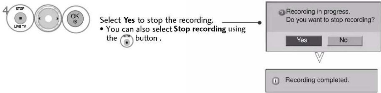 LG 50PS70FD - Start/Stop record - 4