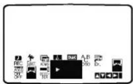 Screenshot of a media player interface with labeled buttons and playback controls