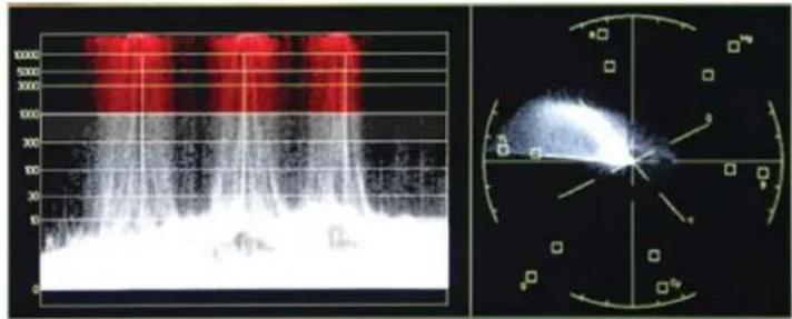 Medical imaging panel showing a 3D scan with red and white regions, alongside a radar chart with angular markers and scale.