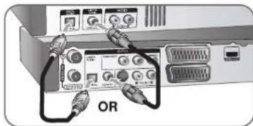 LG RH399M - Digital audio connection - 1