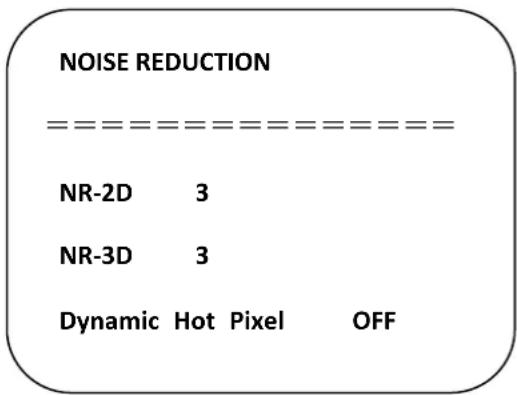 Alfatron ALF-20X-SD-TC - 5) Noise reduction - 1