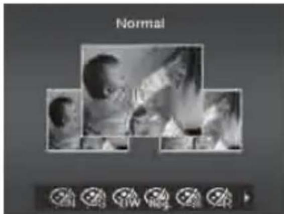 Normal