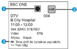 BBC ONE DTV City Hospital 11:00 - 12:00 Ses (ENG) STEREO Video 576i Altyazi Kapali Time shift the cynatima yapriabilir. >> Yeni bilgi