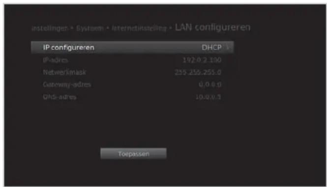 HUMAX iHDR-5200C - LAN (IP) configureren - 1