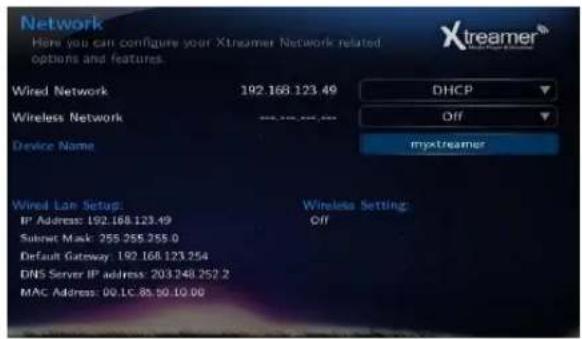 Xtreamer Prodigy - Wireless LAN Setup - 2