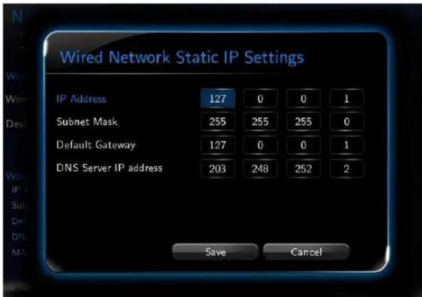Xtreamer Prodigy - DHCP IP (AUTO) - 1