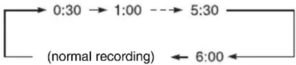 SONY RDR-GXD360 - Press ● REC repeatedly to set the duration. - 1