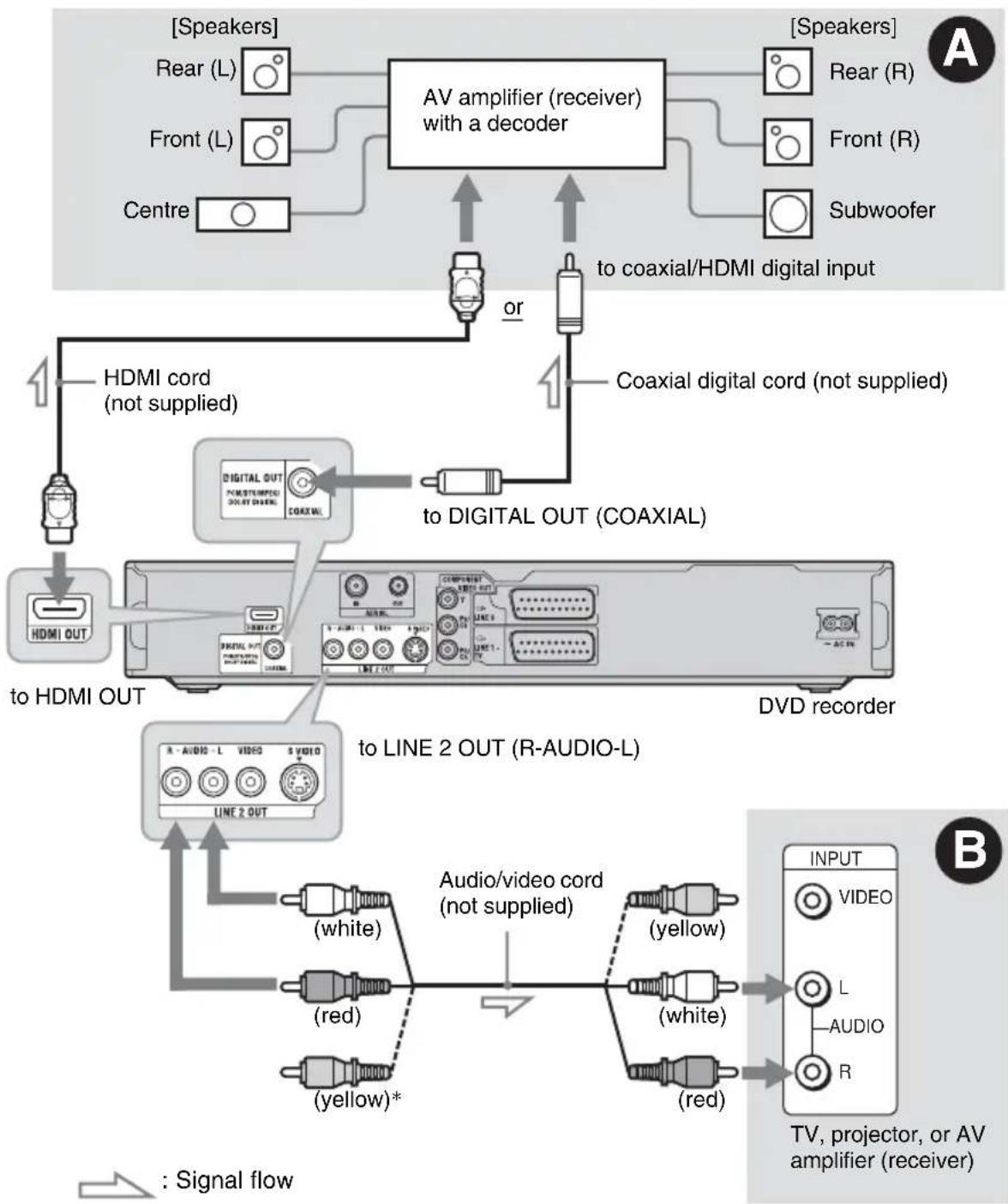 SONY RDR-HXD860 - Step 3: Connecting the Audio Cords - 1