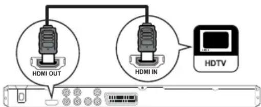 PHILIPS DVP3580 - Remarque - 1