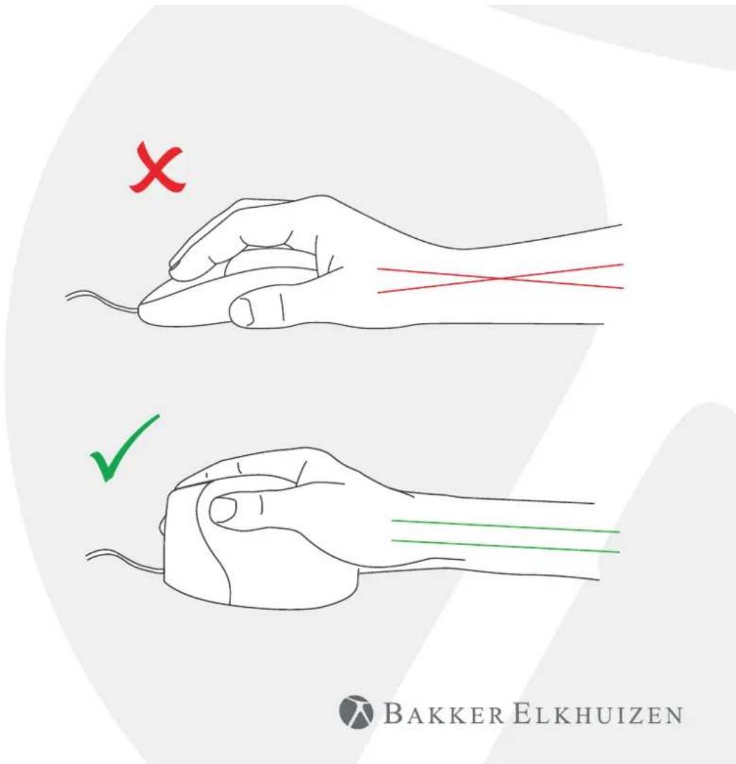 BakkerElkhuizen Evoluent Standard - 1