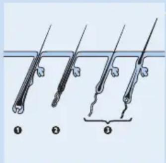 Diagram showing three types of medical or surgical instruments with labeled parts ①, ②, and ③, likely illustrating a procedure or procedure.