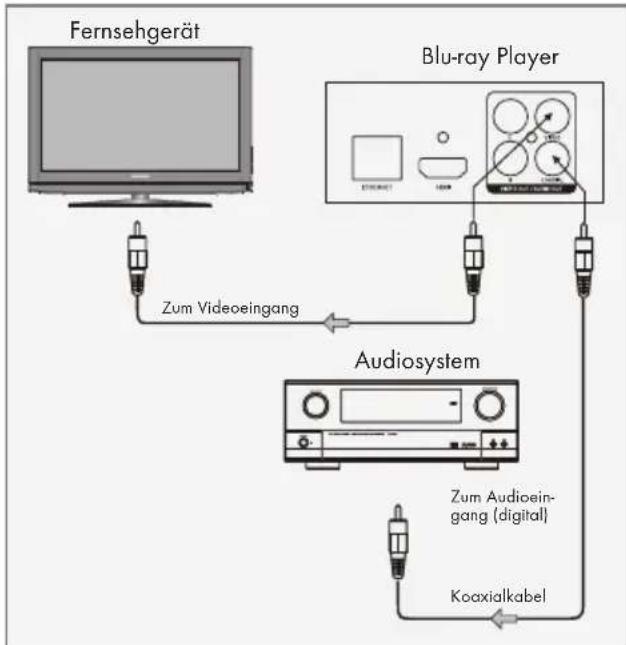 GRUNDIG GBP 6100 - Digitales Audiosystem anschließen – mit einem Cinch-Kabel - 1