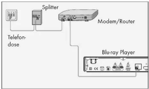 GRUNDIG GBP 6100 - LAN-Verbindung zum Internet - 1