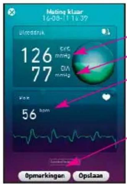 MEDISANA 51281 CardioDock - Het meetresultaat - 1