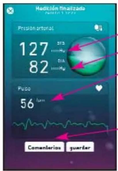 MEDISANA 51281 CardioDock - El resultado de la medición - 1