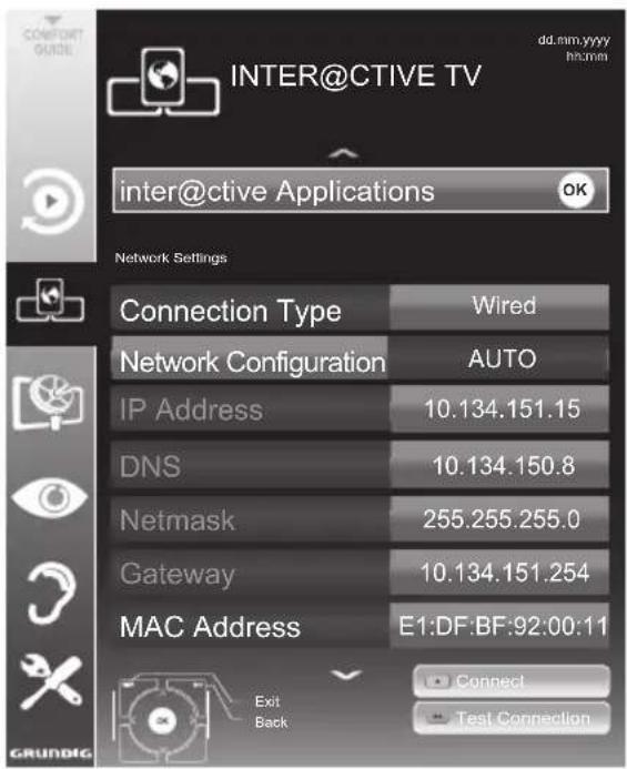 GRUNDIG 40 VLE 8270 SL - Automatic wired network connection - 1
