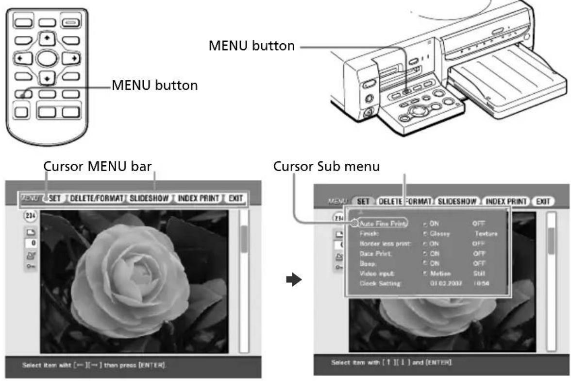SONY DPP-SV88 - What you can do with the MENU - 1