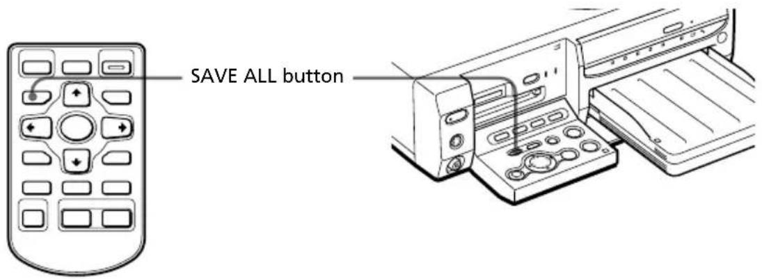 SAVE ALL button