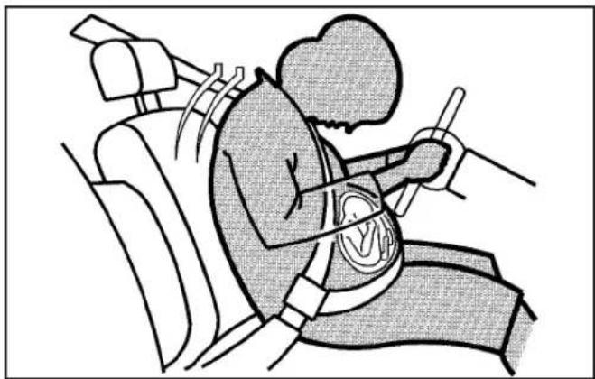 CHEVROLET Cobalt (2009) - Safety Belt Use During Pregnancy - 1