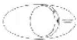 SEVERIN KS 9892 - Thermostat - 1