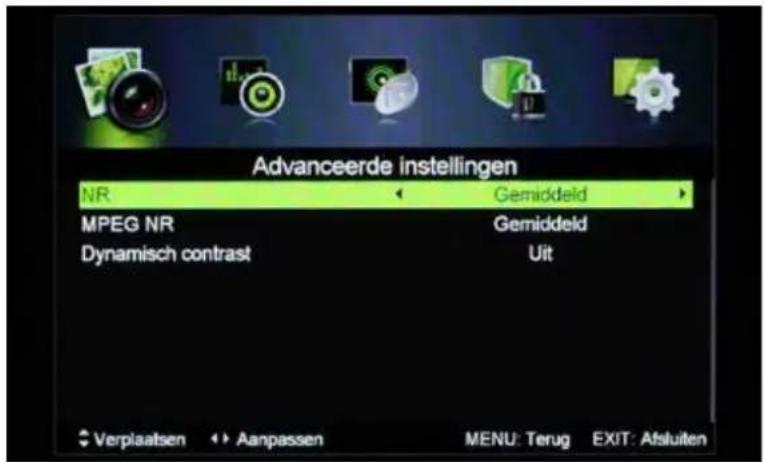 MT Logic LE-207837MT - Geavanceerde instellingen (Niet beschikbaar voor de PC-modus) - 1
