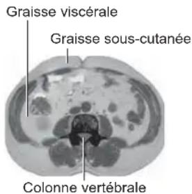 OMRON BF508 - Graisse viscérale = graisse entourant les organes internes - 1