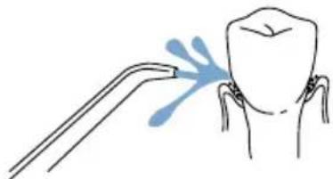 Waterpik WP-270 - Higiene dental con el irrigador bucal Waterpik® - 1