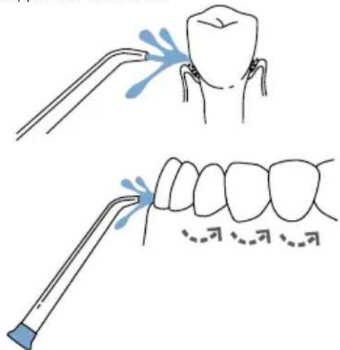 Waterpik WP-270 - Recommended Technique - 1