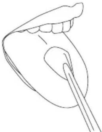 Waterpik WP-110 - Tongue Cleaner Tip - 1