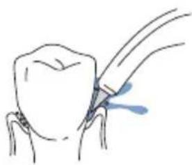 Waterpik WP-110 - Pik Pocket™ Tip - 1