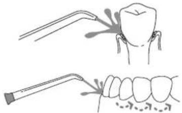 Waterpik WP-60 - Technique recommandée - 1