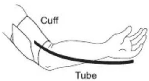 A&D Médical UA-704 - ■ Cuff Size Indicator On The Cuff - 4