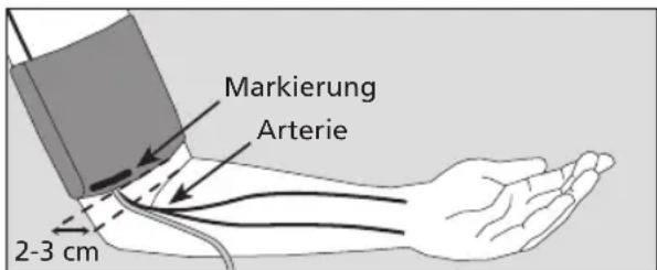 BOSO Medicus Control - Vorbereitung zur Blutdruckmessung - 1