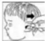 MICROLIFE IR 1DE1 - Instructions d'utilisation - 4