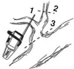 HUSQVARNA 353G E-Tech TrioBrake - Élagage - 1