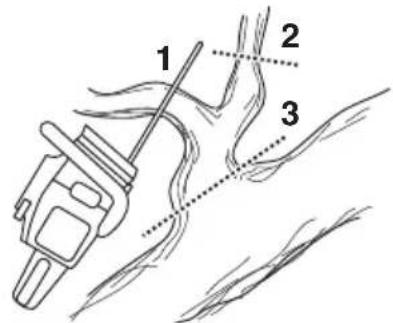 HUSQVARNA 545 TrioBrake - Snoeien - 1