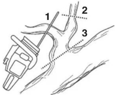 HUSQVARNA 545 TrioBrake - Élagage - 1