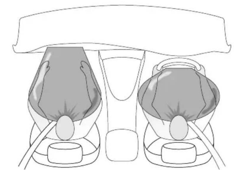 Rover 75 (1999) - Airbags will only deploy when they are required to supplement the restraining force of the seat belts. - 1
