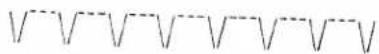 PFAFF 297-1 - Shell-edge stitch - 1