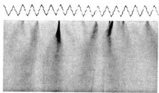 PFAFF 6250 - Stretch triple zigzag stitch - 1
