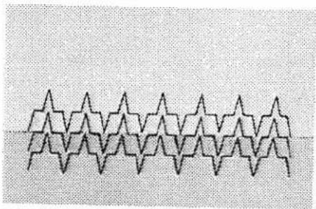 PFAFF 79 - Inserting Patches - 11