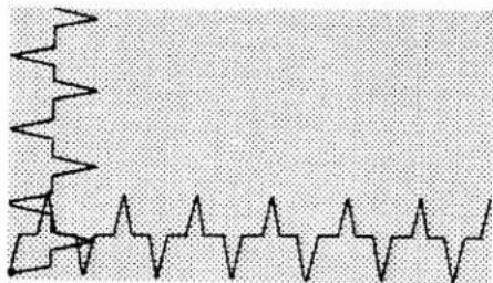 PFAFF 79 - Inserting Patches - 2